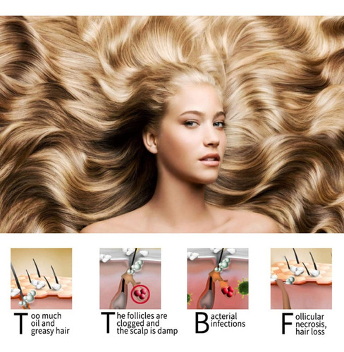 . 4x Shampoo Natural Stick Para Parar A Queda De Cabelo