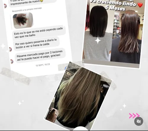 Kit Completo Anticaida , De La Línea Rapunzel