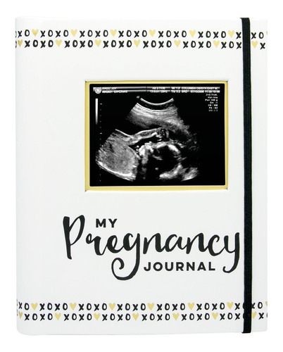 Pearhead My Pregnancy Journal, Libro De Recuerdos De Embaraz