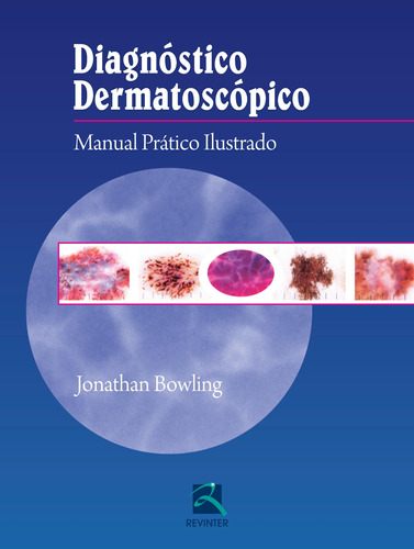 Diagnóstico Dermatoscópico, de Bowling, Jonathan. Editora Thieme Revinter Publicações Ltda, capa dura em português, 2013