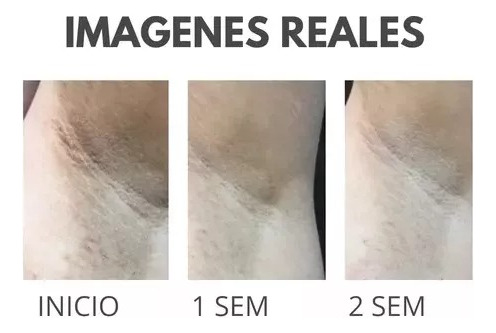 Crema Blanqueadora Aclaradora Partes Intimas, Ojeras Manchas