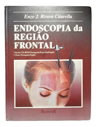 Endoscopía De La Región Frontal - En Portugués - Enzo Rivera