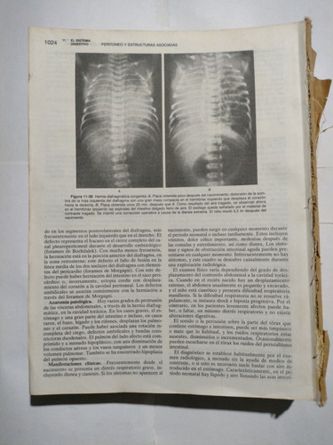 Tratado De Pediatria By Nelson (roto E Incompleto) Novena Ed