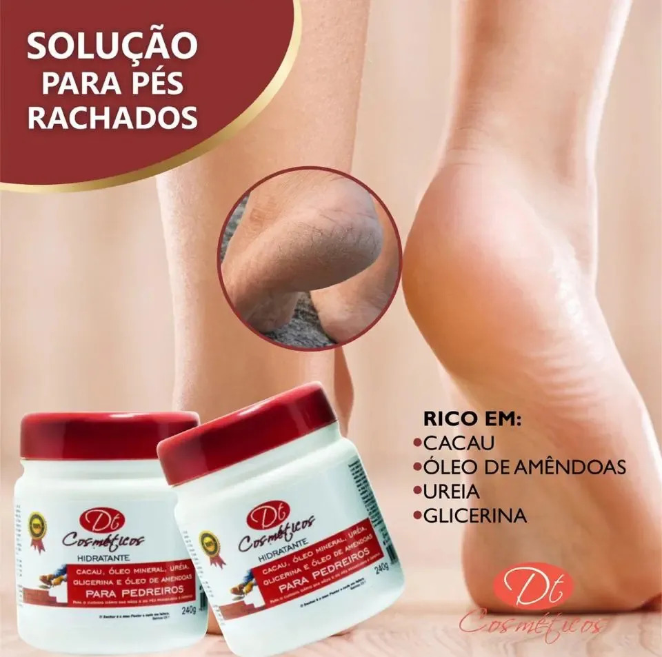Creme Hidratante Do Pedreiro Para Mão Pés 55 G
