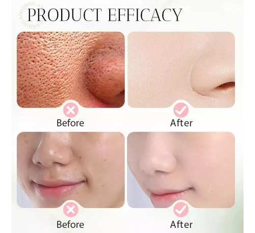 Gel Exfoliante Purificante Jorondy, Gel Exfoliante Jorondy*2