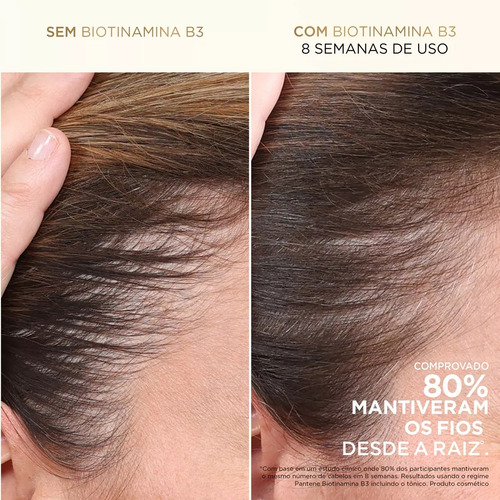 Shampoo Pantene Pro-V Biotinamina B3 300ml