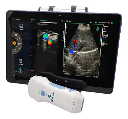 Equipos De Ecografia Inalámbricos Echopalm