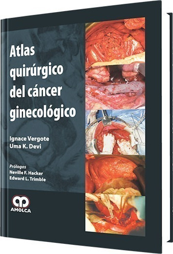 Atlas Quirúrgico Del Cáncer Ginecológico