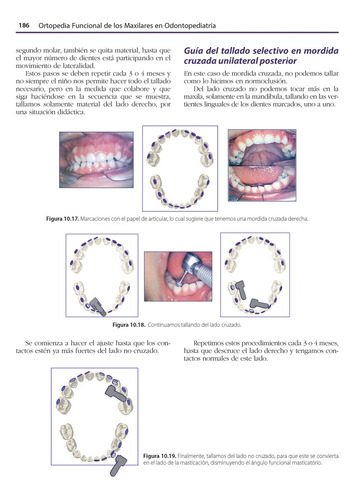 Ortopedia Funcional De Los Maxilares En Odontopediatría. Incluye E-book: Rehabilitación Neuroclusal Precoz, De Margarita Ponce Palomares. Editorial Amolca, Tapa Dura, Edición 1 En Español, 2024