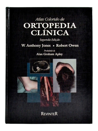 Livro - Atlas Colorido De Ortopedia Clínica - Jones - Owen