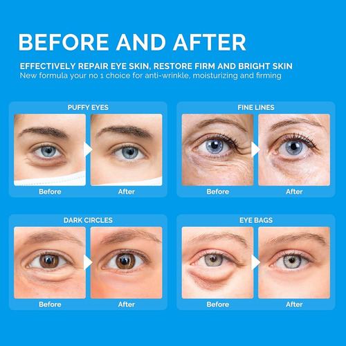 Parches Reductores De Ojeras Con Collageno Enaskin 30 Pares