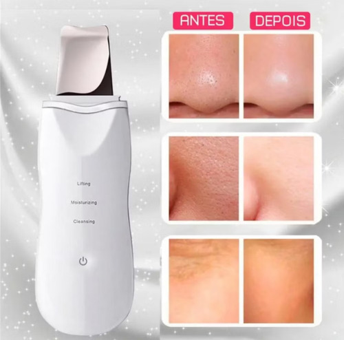 Aparelho Ultrassonico Para Pelling