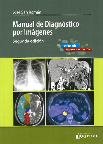 Libro Manual De Diagnóstico Por Imágenes De José Luis San Ro