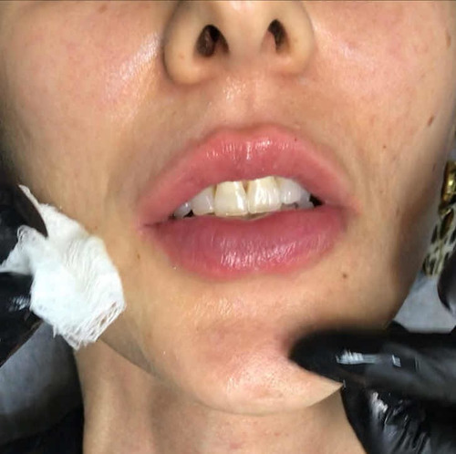 Imagem 2 de 5 de Reabilitação Oral E Harmonização Orofacial
