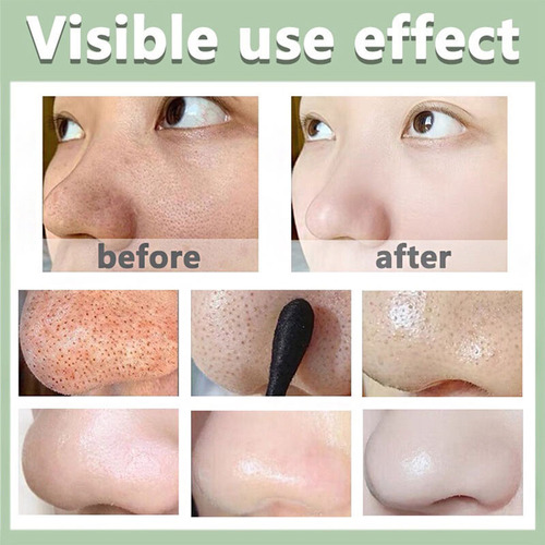Máscara De Chá Verde Stick Tira Acne Espinhas Limpa Pele 40g