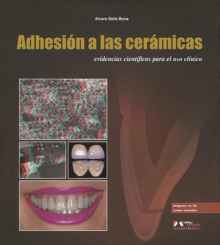 Libro Adhesion A Las Ceramicas De Alvaro Della Bona Ed: 1