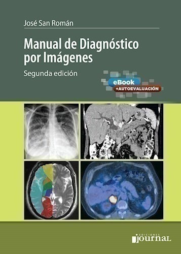 Manual De Diagnóstico Por Imágenes Ed.2º - San Román, José