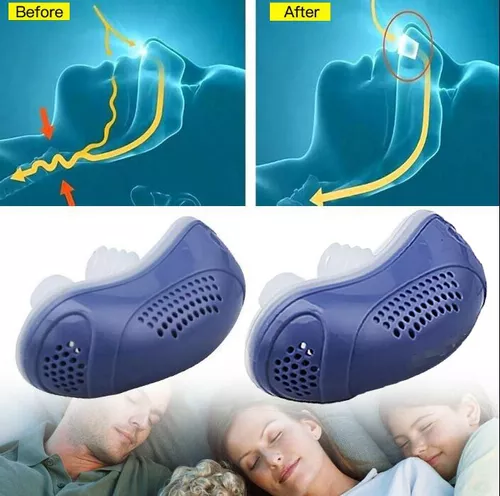 Micro Cpap Dispositivo Electrónico Anti Ronquidos Para Apnea