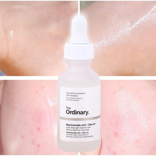 Sérum Niacinamida 10% + Zinco 1% The Ordinary 30 Ml Todo Tipo De Pele Dia/noite