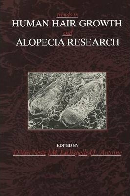 Trends In Human Hair Growth And Alopecia Research - J. L....