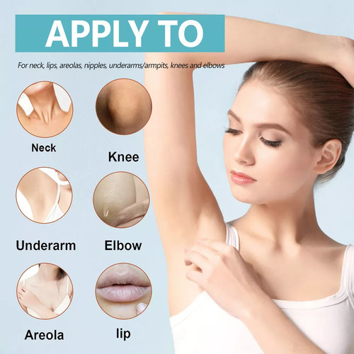 An Acanthosis Nigricans Therapy, 1 Unidade De Creme