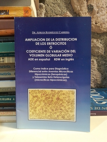 Amplia De La Distribución De Los Eritrocitos Ó Coeficiente (Usado)