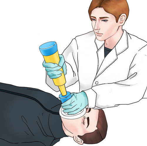 Anti Choking Device/choking Rescue Device With Two Mask