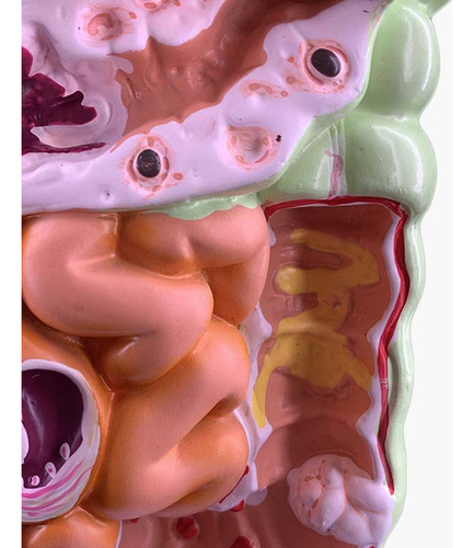 Modelo Do Sistema Digestivo Humano Anatomia Do Estômago Inte