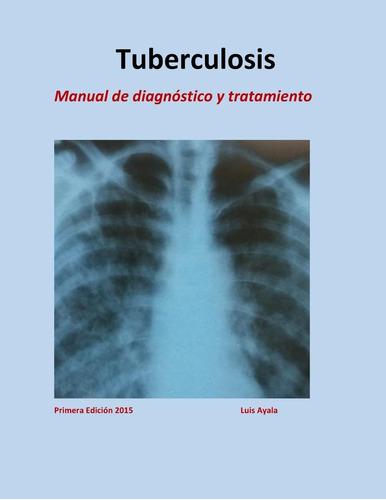 Libro: Tratamiento De Tuberculosis: Manual De Diagnóstico Y 