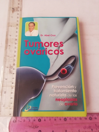 Tumores Ováricos Abel Cruz Ediciones Bionatura 