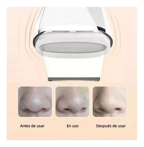 Limpiador Facial Ultrasónico 2 En 1 Con Exfoliador Ti Blanco