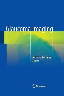 Libro Glaucoma Imaging - Antonio Ferreras