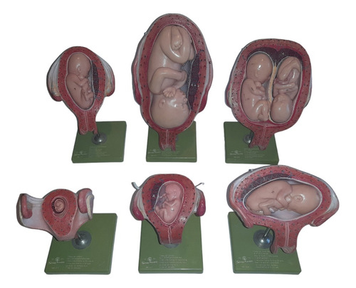 Utero Con Feto Gestacion Modelo De Anatomia Somso Alemania