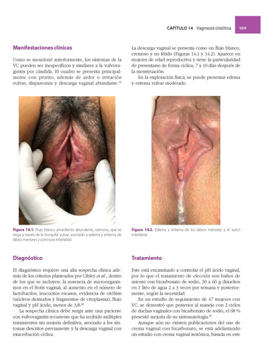 Enfoque Sindromático De La Enfermedad Vulvar. Inc.14 Videos