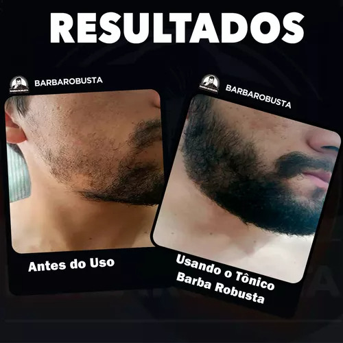 Kit Tônico Poderoso - Calvície - Alopecia - Queda/cabelo