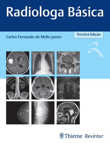 Radiologia Básica, de Junior, Carlos Fernando de Mello. Editora Thieme Revinter Publicações Ltda, capa dura em português, 2021