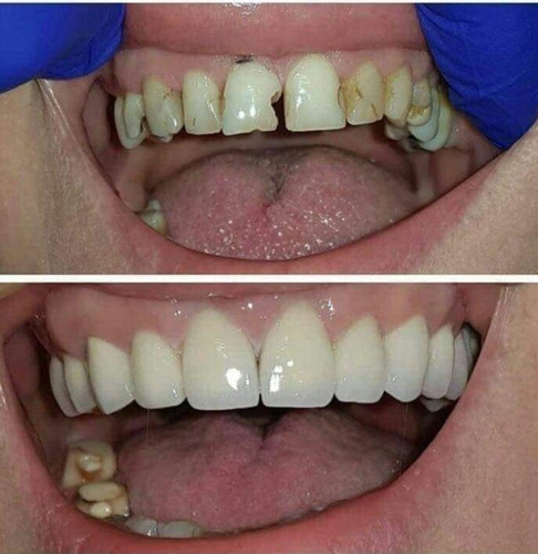 Imagem 1 de 5 de Tratamento Dentário No Boleto.