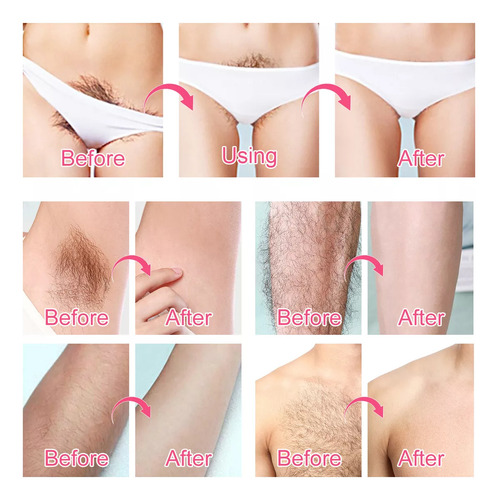 Crema Depilatoria Área Íntima Sensible Sin Dolor Bye Vello