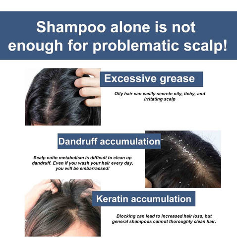 Shampoo De Enxofre Para Controlar A Limpeza De Óleo E Folícu