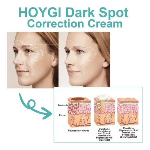 La Crema Correctora Ej Spot Aclara Las Manchas Oscuras