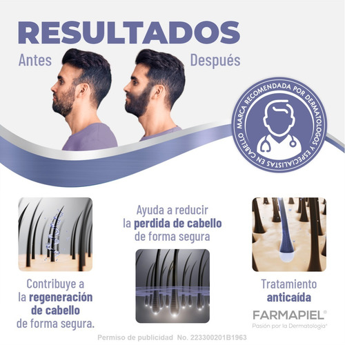 Imagen 3 de 7 de Spray Anacastel Minoxidil 5% Solución Cabello Y Barba 60 Ml