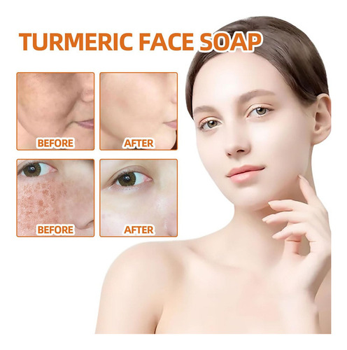 Xj Turmeric Bar Soap, Lemon Turmeric Soap Bar, Turmeric