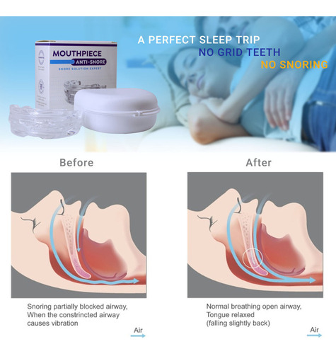 Ronquidos Prevención Bruxism Frens, 2 Units