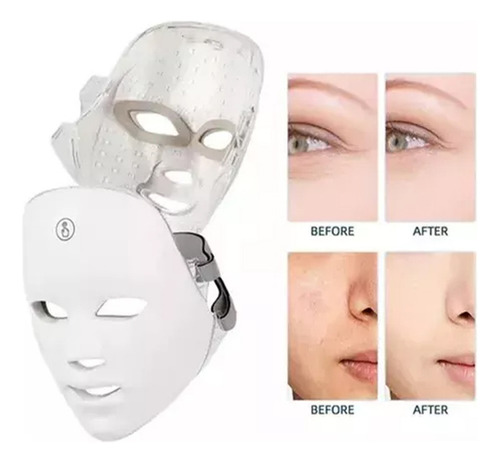 Mascara Led Estética Facial 7 Cores Tratamento Facial