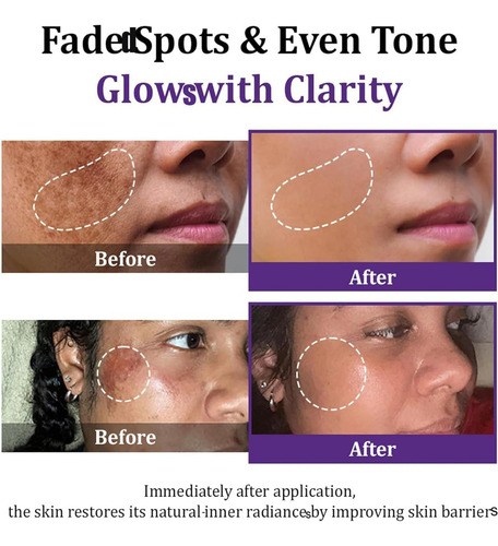 Creme Anti-hiperpigmentação Epiglow Melanex Advanced, Creme