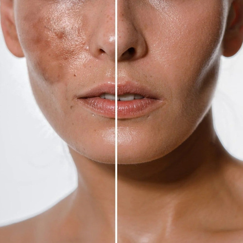 2 Cremas Blancoderma Quita Manchas Piel Facial Aclarador Bla Mixta Noche