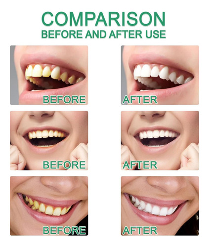 Creme Dental Com Niacinamida, Creme Dental Clareador Com