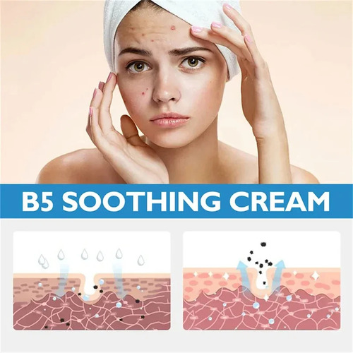La Crema Blanqueadora Para Imperfecciones Elimina Eficazment