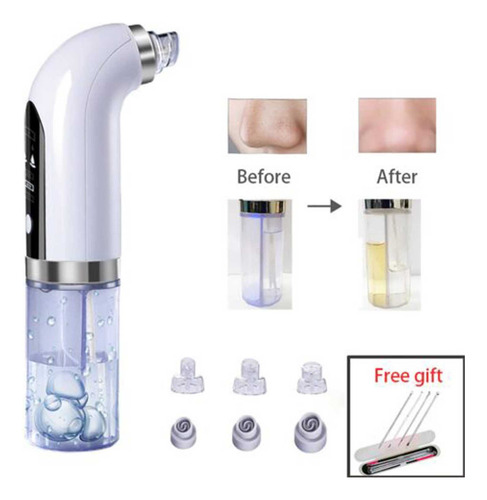 Aspirador De Pó U Blackhead Remover Pore - Electric Facial B
