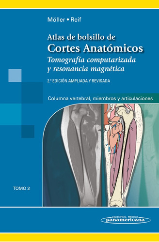 Moller - Atlas De Bolsillo De Cortes Anatómicos Tomo 3